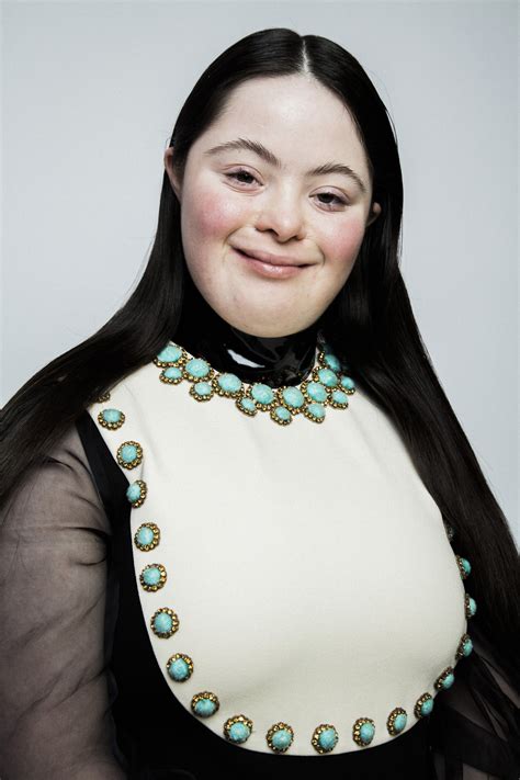 down syndrome gucci|down syndrome model gucci.